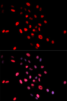 JUN / c-Jun Antibody - Immunofluorescence analysis of MCF7 cells.