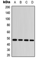JUN / c-Jun Antibody - Western blot analysis of c-Jun (pS63) expression in MCF7 (A); HeLa UV-treated (B); NIH3T3 (C); PC12 (D) whole cell lysates.