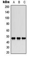 JUN / c-Jun Antibody - Western blot analysis of c-Jun (pS73/100) expression in A549 (A); human brain cancer (B); K562 (C) whole cell lysates.