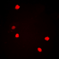 JUN / c-Jun Antibody - Immunofluorescent analysis of c-Jun (pS73/100) staining in HepG2 cells. Formalin-fixed cells were permeabilized with 0.1% Triton X-100 in TBS for 5-10 minutes and blocked with 3% BSA-PBS for 30 minutes at room temperature. Cells were probed with the primary antibody in 3% BSA-PBS and incubated overnight at 4 deg C in a humidified chamber. Cells were washed with PBST and incubated with a DyLight 594-conjugated secondary antibody (red) in PBS at room temperature in the dark. DAPI was used to stain the cell nuclei (blue).
