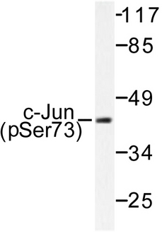 JUN / c-Jun Antibody - Western blot of p-c-Jun (S73) pAb in extracts from HeLa cells treated with UV.