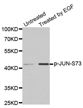 JUN / c-Jun Antibody - Western blot analysis of extracts from PC14 cells.