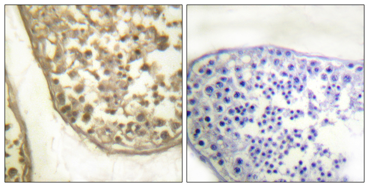 JUN / c-Jun Antibody - Immunohistochemistry analysis of paraffin-embedded human testis, using c-Jun (Phospho-Thr231) Antibody. The picture on the right is blocked with the phospho peptide.