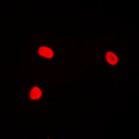JUN / c-Jun Antibody - Immunofluorescent analysis of c-Jun (pT239) staining in HeLa cells. Formalin-fixed cells were permeabilized with 0.1% Triton X-100 in TBS for 5-10 minutes and blocked with 3% BSA-PBS for 30 minutes at room temperature. Cells were probed with the primary antibody in 3% BSA-PBS and incubated overnight at 4 deg C in a humidified chamber. Cells were washed with PBST and incubated with a DyLight 594-conjugated secondary antibody (red) in PBS at room temperature in the dark. DAPI was used to stain the cell nuclei (blue).