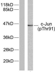 JUN / c-Jun Antibody - Western blot analysis of lysates from HeLa cells treated with UV, using c-Jun (Phospho-Thr91) Antibody. The lane on the left is blocked with the phospho peptide.