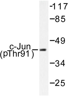 JUN / c-Jun Antibody - Western blot of p-c-Jun (T91) pAb in extracts from HeLa cells treated with UV.