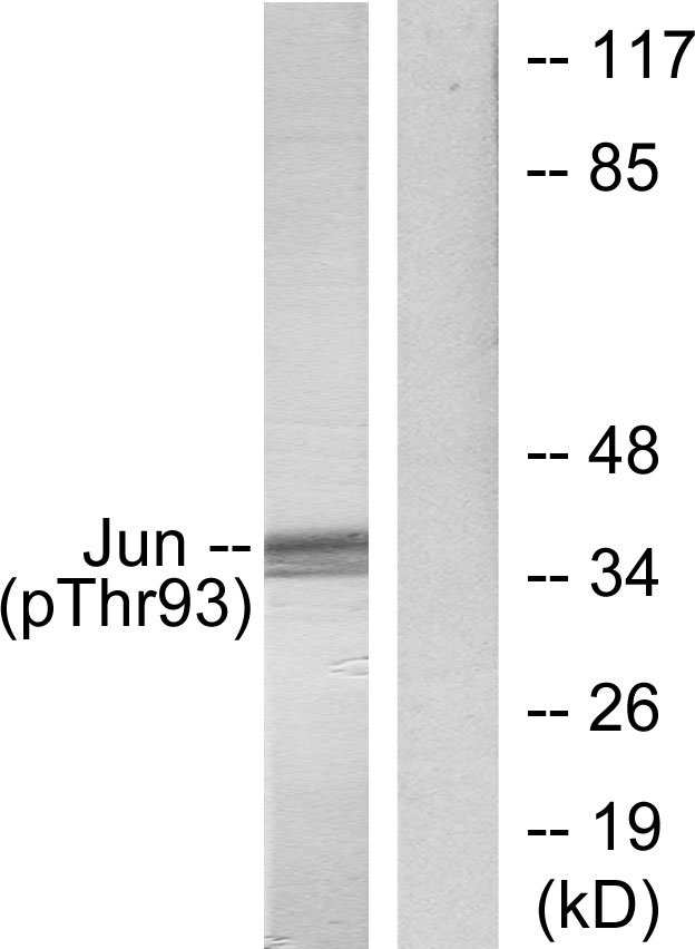 JUN / c-Jun Antibody - Western blot analysis of lysates from HeLa cells treated with UV, using c-Jun (Phospho-Thr93) Antibody. The lane on the right is blocked with the phospho peptide.