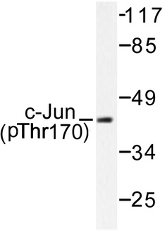 JUN / c-Jun Antibody - Western blot of p-c-Jun (Y170) pAb in extracts from HeLa cells treated with UV.