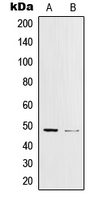 JUN / c-Jun Antibody - Western blot analysis of c-Jun (pY170) expression in K562 UV-treated (A); HeLa Anisomycin-treated (B) whole cell lysates.