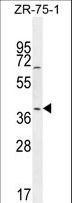 JUNB / JUN-B Antibody - JUNB Antibody western blot of ZR-75-1 cell line lysates (35 ug/lane). The JUNB antibody detected the JUNB protein (arrow).
