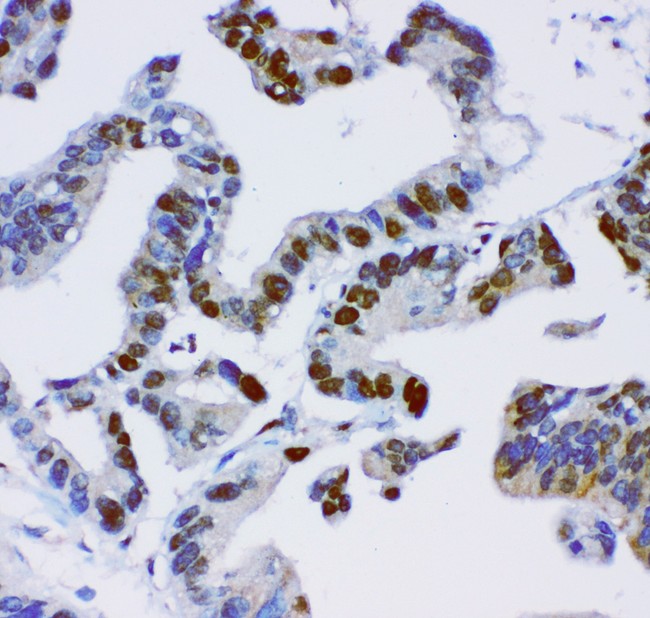 Anti-JUNB / JUN-B Antibody | Rabbit Anti-Human Polyclonal IHC,WB | LSBio