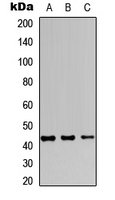 JUNB / JUN-B Antibody - Western blot analysis of JUNB expression in MCF7 (A); Raw264.7 (B); PC12 (C) whole cell lysates.