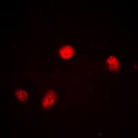 JUNB / JUN-B Antibody - Immunofluorescent analysis of JUNB staining in HEK293 cells. Formalin-fixed cells were permeabilized with 0.1% Triton X-100 in TBS for 5-10 minutes and blocked with 3% BSA-PBS for 30 minutes at room temperature. Cells were probed with the primary antibody in 3% BSA-PBS and incubated overnight at 4 deg C in a humidified chamber. Cells were washed with PBST and incubated with a DyLight 594-conjugated secondary antibody (red) in PBS at room temperature in the dark. DAPI was used to stain the cell nuclei (blue).