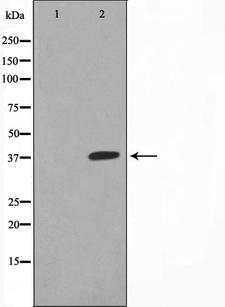 JUNB / JUN-B Antibody - Western blot analysis of JunB expression in HeLa whole cells lysates. The lane on the left is treated with the antigen-specific peptide.