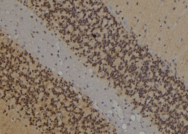 JUNB / JUN-B Antibody - 1:100 staining rat brain tissue by IHC-P. The sample was formaldehyde fixed and a heat mediated antigen retrieval step in citrate buffer was performed. The sample was then blocked and incubated with the antibody for 1.5 hours at 22°C. An HRP conjugated goat anti-rabbit antibody was used as the secondary.