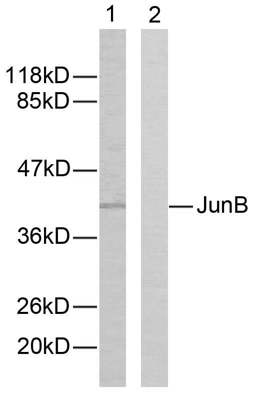 JUNB / JUN-B Antibody - Western blot analysis of extracts from HeLa cells using JunB (Ab-259) antibody.
