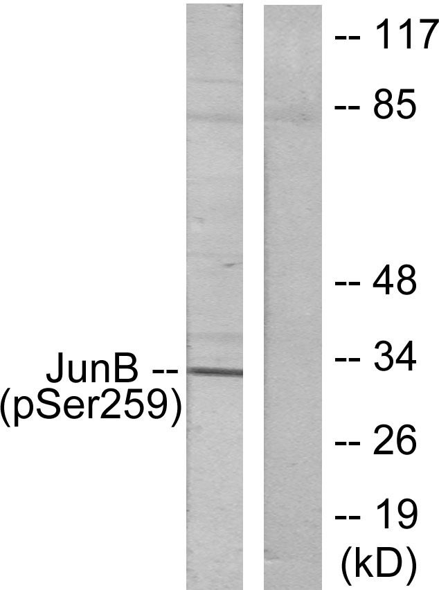 JUNB / JUN-B Antibody - Western blot analysis of lysates from HeLa cells, using JunB (Phospho-Ser259) Antibody. The lane on the right is blocked with the phospho peptide.