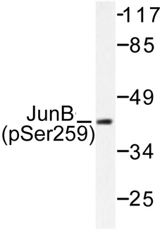 JUNB / JUN-B Antibody - Western blot of p-JunB (S259) pAb in extracts from HeLa cells.