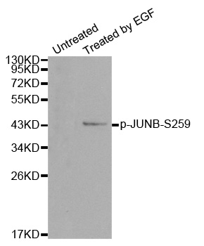 JUNB / JUN-B Antibody - Western blot analysis of extracts from HT29 cells.