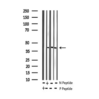 JUNB / JUN-B Antibody - Western blot analysis of Phospho-JunB (Ser259) expression in various lysates
