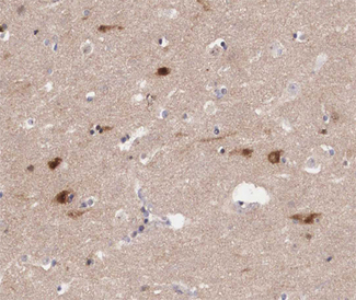 JUNB / JUN-B Antibody - 1:200 staining human brain tissue by IHC-P. The tissue was formaldehyde fixed and a heat mediated antigen retrieval step in citrate buffer was performed. The tissue was then blocked and incubated with the antibody for 1.5 hours at 22°C. An HRP conjugated goat anti-rabbit antibody was used as the secondary.