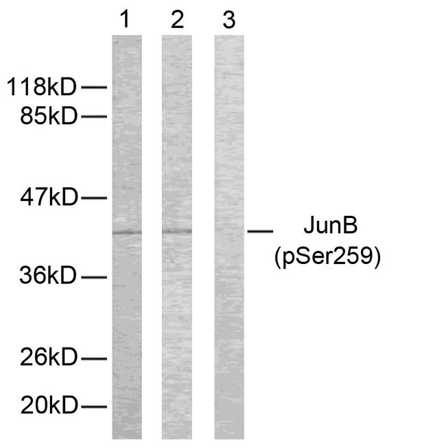 JUNB / JUN-B Antibody - Western blot analysis of extracts from HeLa cells using JunB (phospho-Ser259) antibody.
