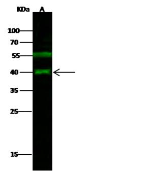 JUNB / JUN-B Antibody - Anti-JUNB rabbit polyclonal antibody at 1:500 dilution. Lane A: MCF7 Whole Cell Lysate. Lysates/proteins at 30 ug per lane. Secondary: Goat Anti-Rabbit IgG H&L (Dylight 800) at 1/10000 dilution. Developed using the Odyssey technique. Performed under reducing conditions. Predicted band size: 36 kDa. Observed band size: 40 kDa. (We are unsure as to the identity of these extra bands.)