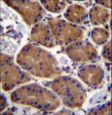 Junctin / ASPH Antibody - ASPH Antibody immunohistochemistry of formalin-fixed and paraffin-embedded human stomach tissue followed by peroxidase-conjugated secondary antibody and DAB staining.