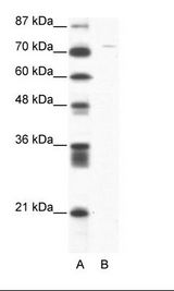 Junctin / ASPH Antibody - A: Marker, B: Jurkat Cell Lysate.  This image was taken for the unconjugated form of this product. Other forms have not been tested.