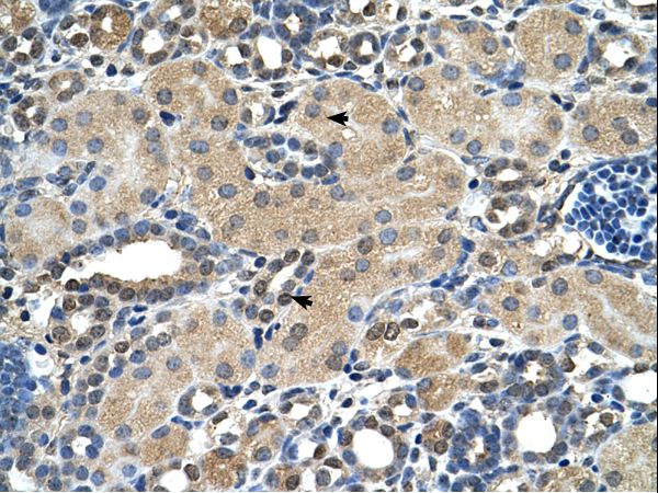 Junctin / ASPH Antibody - ASPH antibody ASPH(aspartate beta-hydroxylase) Antibody was used in IHC to stain formalin-fixed, paraffin-embedded human kidney.  This image was taken for the unconjugated form of this product. Other forms have not been tested.