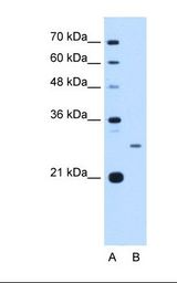 Junctin / ASPH Antibody - Lane A: Marker. Lane B: HepG2 cell lysate. Antibody concentration: 2.5 ug/ml. Gel concentration: 12%.  This image was taken for the unconjugated form of this product. Other forms have not been tested.