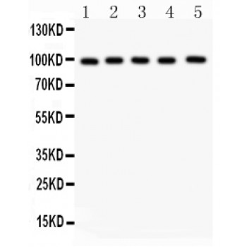 Junctin / ASPH Antibody - ASPH antibody Western blot. All lanes: Anti ASPH at 0.5 ug/ml. Lane 1: Rat Brain Tissue Lysate at 50 ug. Lane 2: Rat Liver Tissue Lysate at 50 ug. Lane 3: HELA Whole Cell Lysate at 40 ug. Lane 4: HEPG2 Whole Cell Lysate at 40 ug. Lane 5: HEPA Whole Cell Lysate at 40 ug. Predicted band size: 86 kD. Observed band size: 100 kD.