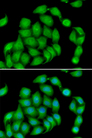 Junctin / ASPH Antibody - Immunofluorescence analysis of HeLa cells.