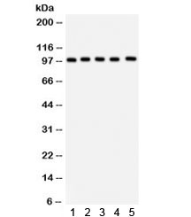 Junctin / ASPH Antibody