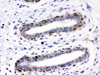 Junctin / ASPH Antibody
