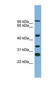 Junctin / ASPH Antibody - ASPH antibody Western blot of Fetal Stomach lysate. This image was taken for the unconjugated form of this product. Other forms have not been tested.