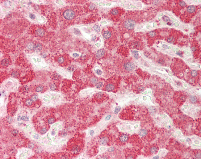 Junctophilin 2 / JPH2 Antibody - Human Liver: Formalin-Fixed, Paraffin-Embedded (FFPE).  This image was taken for the unconjugated form of this product. Other forms have not been tested.