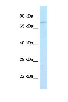 Junctophilin 2 / JPH2 Antibody - JPH2 antibody western blot of Mouse Pancreas lysate. Antibody concentration 1 ug/ml.  This image was taken for the unconjugated form of this product. Other forms have not been tested.