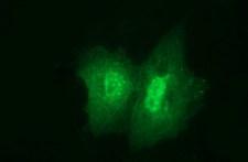 Junctophilin 2 / JPH2 Antibody - Anti-JPH2 mouse monoclonal antibody immunofluorescent staining of COS7 cells transiently transfected by pCMV6-ENTRY JPH2.
