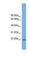 JUNDM2 / JDP2 Antibody - JDP2 antibody Western blot of Mouse Heart lysate. This image was taken for the unconjugated form of this product. Other forms have not been tested.