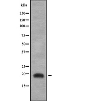 JUNDM2 / JDP2 Antibody - Western blot analysis of JDP2 using COLO205 whole cells lysates