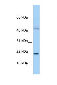 JUNDM2 / JDP2 Antibody - JDP2 antibody Western blot of 3 Cell lysate. Antibody concentration 1 ug/ml.  This image was taken for the unconjugated form of this product. Other forms have not been tested.