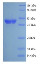 PLY1 / Pectate lyase 1 Protein