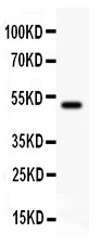 JUP/CTNNG/Junction Plakoglobin Antibody - gamma Catenin antibody Western blot. All lanes: Anti gamma Catenin at 0.5 ug/ml. WB: Recombinant Human gamma Catenin Protein 0.5ng. Predicted band size: 47 kD. Observed band size: 47 kD.