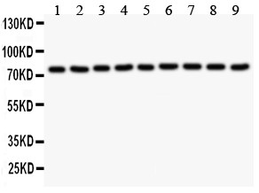 JUP/CTNNG/Junction Plakoglobin Antibody - gamma Catenin antibody Western blot. All lanes: Anti gamma Catenin at 0.5 ug/ml. Lane 1: Rat Brain Tissue Lysate at 50 ug. Lane 2: Rat Cardiac Muscle Tissue Lysate at 50 ug. Lane 3: Rat Thymus Tissue Lysate at 50 ug. Lane 4: RH35 Whole Cell Lysate at 40 ug. Lane 5: HeLa Whole Cell Lysate at 40 ug. Lane 6: Colo320 Whole Cell Lysate at 40 ug. Lane 7: HepG2 Whole Cell Lysate at 40 ug. Lane 8: HepA Whole Cell Lysate at 40 ug. Lane 9: MCF-7 Whole Cell Lysate at 40 ug. Predicted band size: 81 kD. Observed band size: 81 kD.