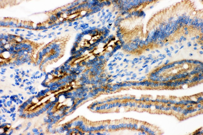 JUP/CTNNG/Junction Plakoglobin Antibody - gamma Catenin antibody IHC-paraffin: Mouse Intestine Tissue.