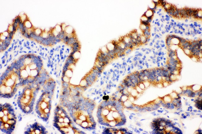 JUP/CTNNG/Junction Plakoglobin Antibody - gamma Catenin antibody IHC-paraffin: Rat Intestine Tissue.