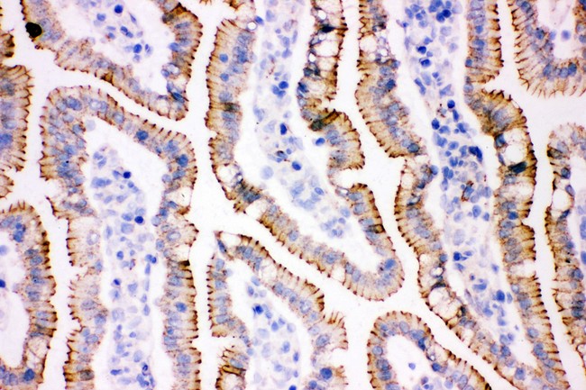 JUP/CTNNG/Junction Plakoglobin Antibody - gamma Catenin antibody IHC-frozen: Rat Intestine Tissue.