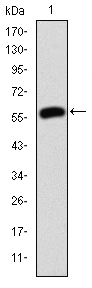 JUP/CTNNG/Junction Plakoglobin Antibody - Western blot using JUP monoclonal antibody against human JUP (AA: 534-740) recombinant protein. (Expected MW is 48.5 kDa)