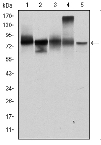 JUP/CTNNG/Junction Plakoglobin Antibody - Western blot using JUP mouse monoclonal antibody against T47D (1), MCF-7 (2), SKBR-3 (3), A431 (4) and HEK293 (5) cell lysate.